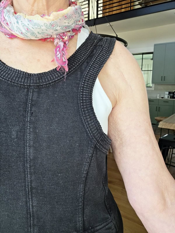 Crepey Skin on Arms
